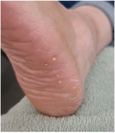 Pedi-care medische pedicure aan huis